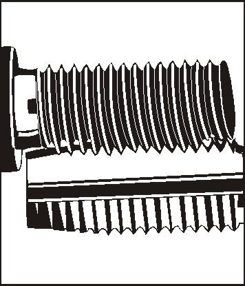 [07216VO] [⚠Déstockage] 07216 GEWINDEEINSATZ M10X1.25 *100* (SACHET)